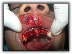 Best dentist in bhopal